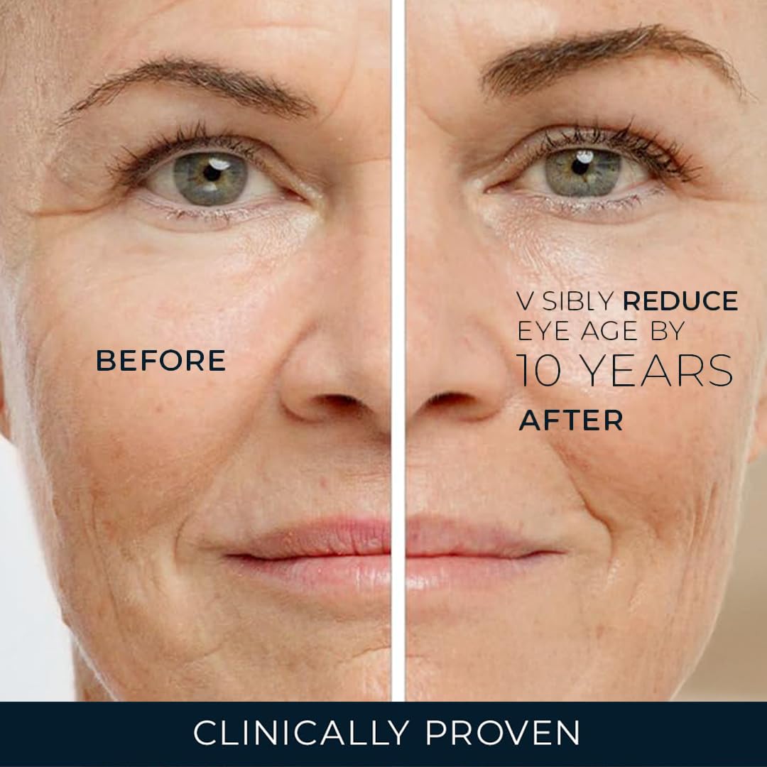 Applying RoC retinol eye cream under eyes
