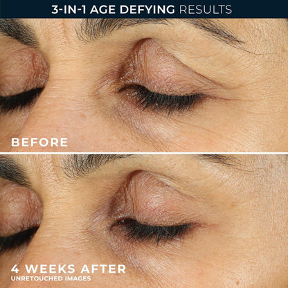 RoC Retinol Correxion Under Eye Cream ingredient details