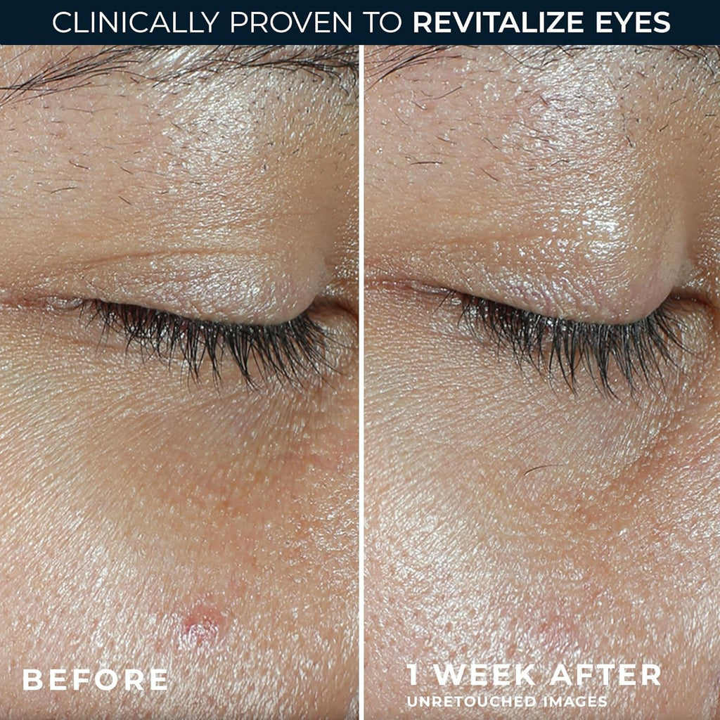RoC vitamin C eye balm application demonstration