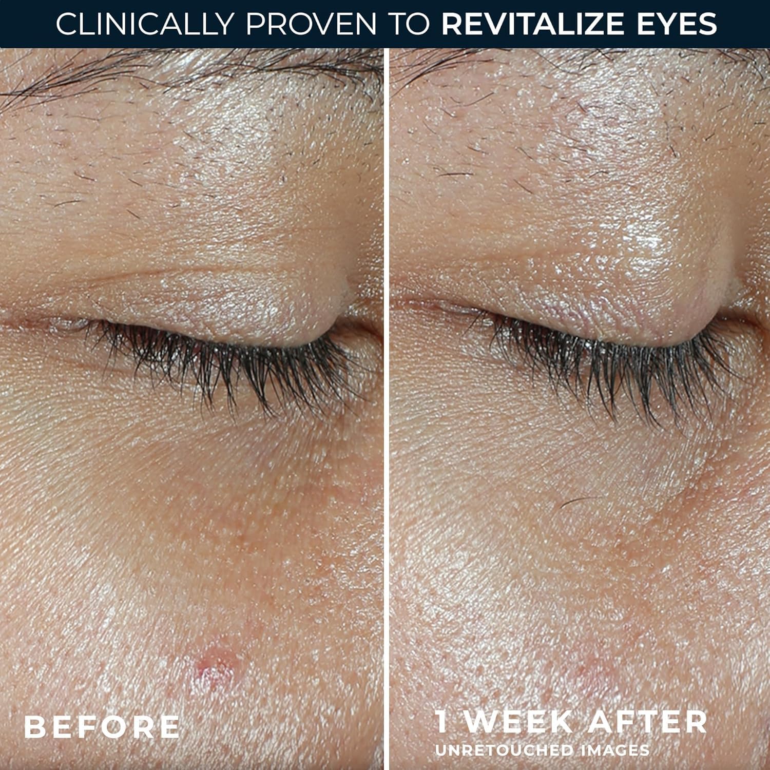 RoC skincare anti-aging eye balm for dark circles side view