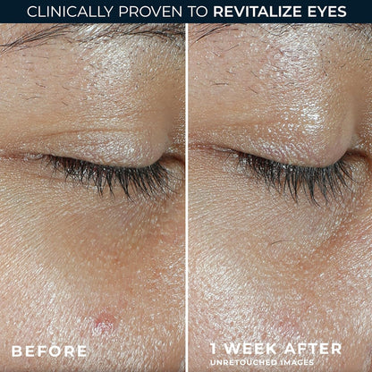 RoC skincare anti-aging eye balm for dark circles side view