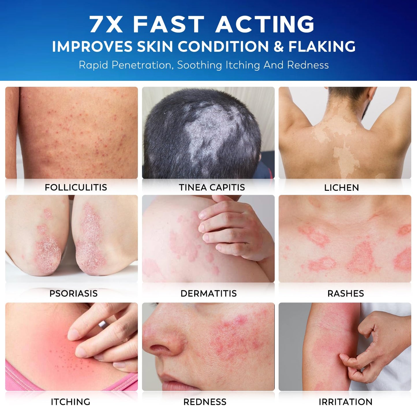 Nedtol 7X fast-acting ointment tube and branding