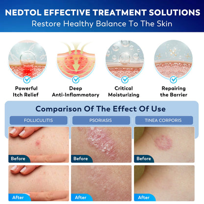 Detailed product label showing folliculitis relief benefits