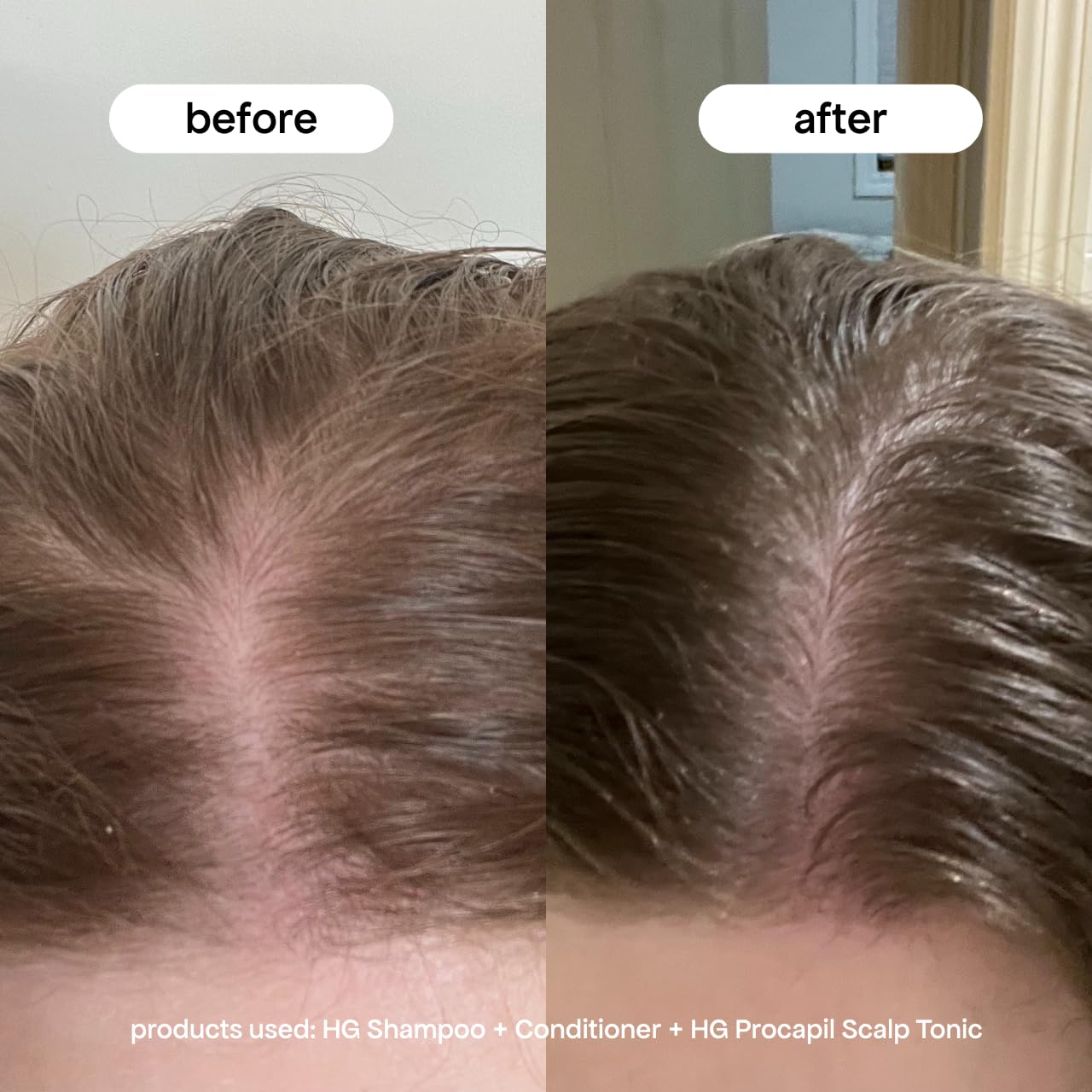 BondiBoost hair tonic label showing Procapil ingredients