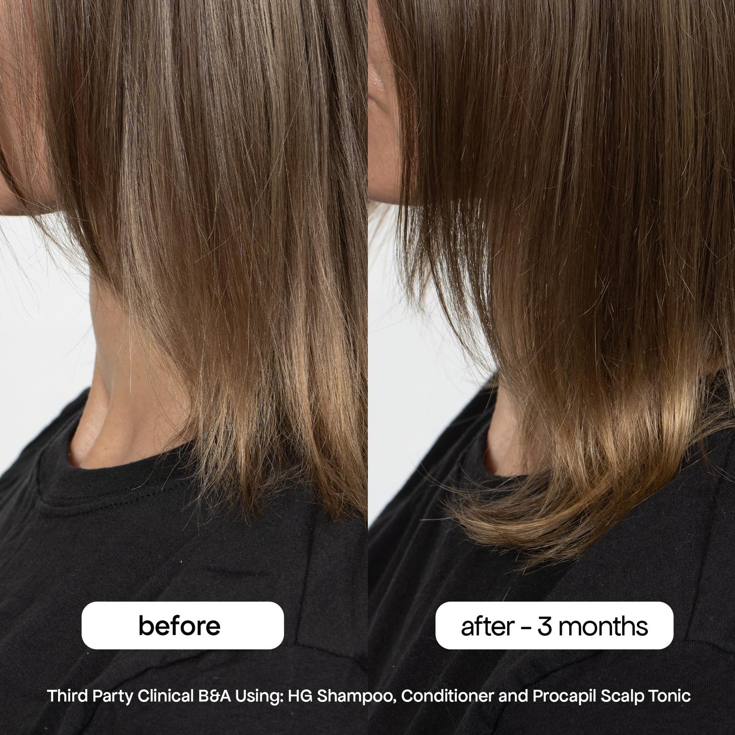 Application of BondiBoost leave-in scalp tonic
