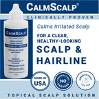 CalmScalp scalp care product for dry and irritated skin