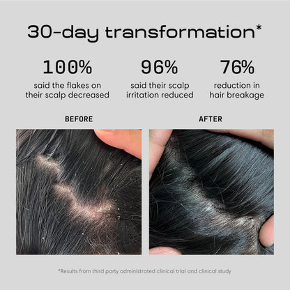 Jupiter anti-dandruff serum packaging back side
