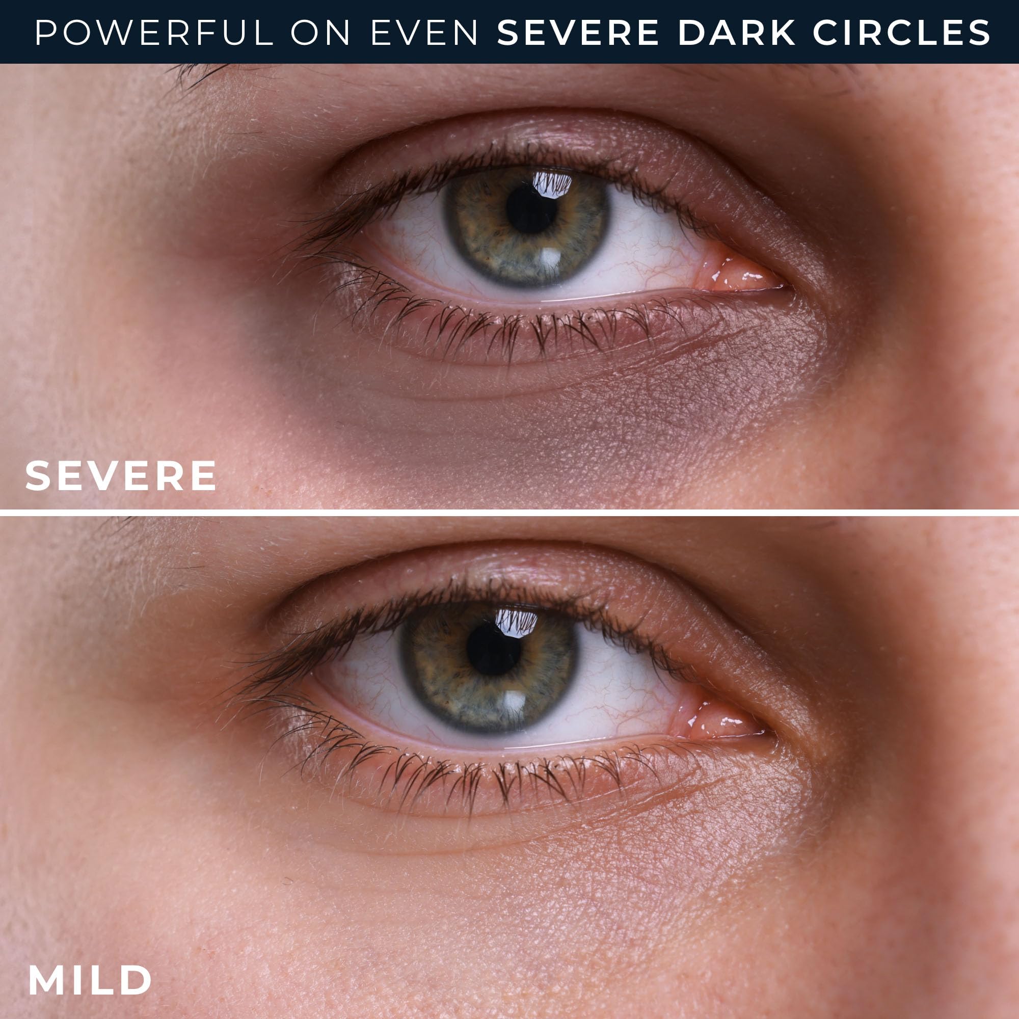 Dermatologist tested anti-aging eye cream containing niacinamide and resveratrol