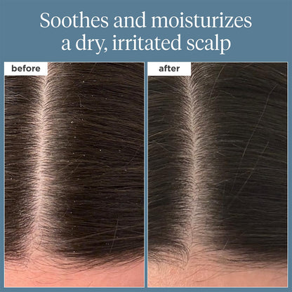 Briogeo Scalp Revival hair oil texture and packaging