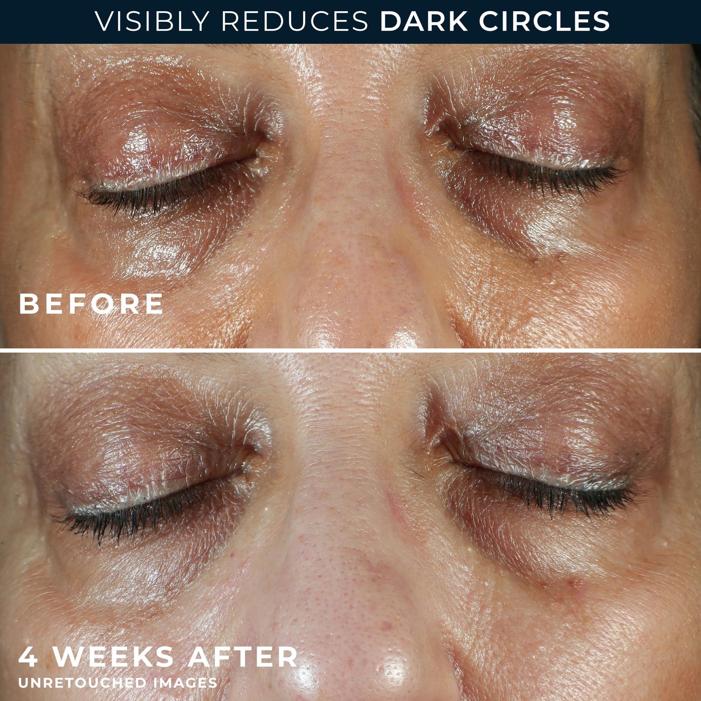 RoC Multi Correxion 5 In 1 Anti Aging Eye Cream with night cream packette