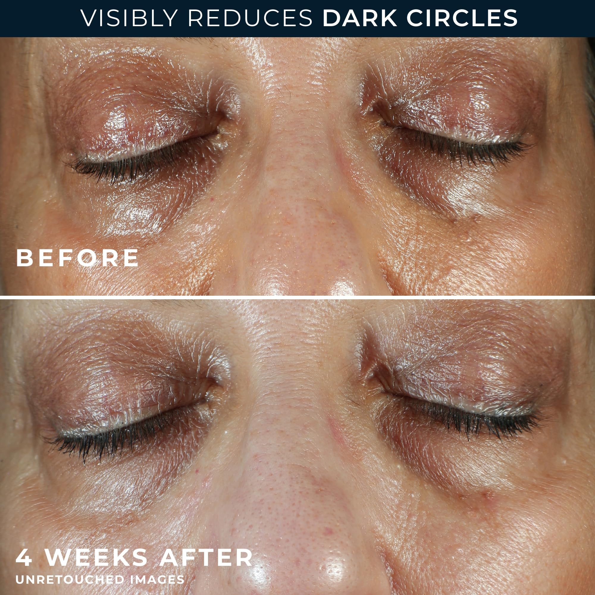 RoC Multi Correxion 5 In 1 Anti Aging Eye Cream with night cream packette