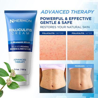 Side view of Hermon Folliculitis Cream packaging