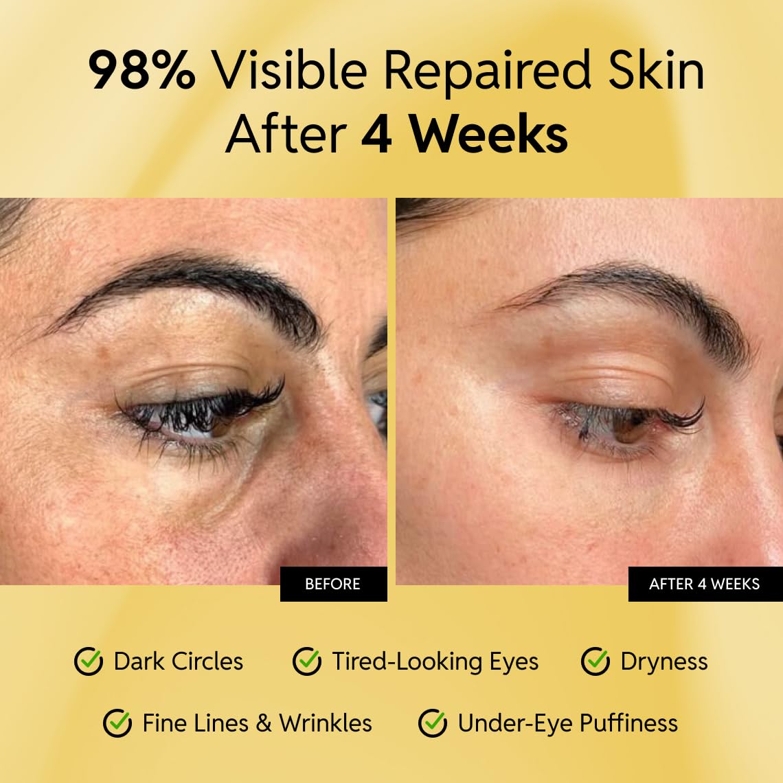 Eliré Korean eye cream tube with ceramides and caffeine for barrier repair on a clean background