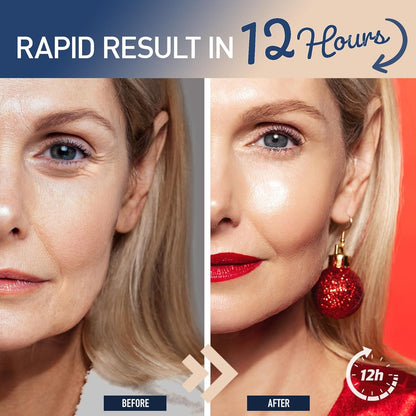 Rapid wrinkle filler serum bottle showing product label details
