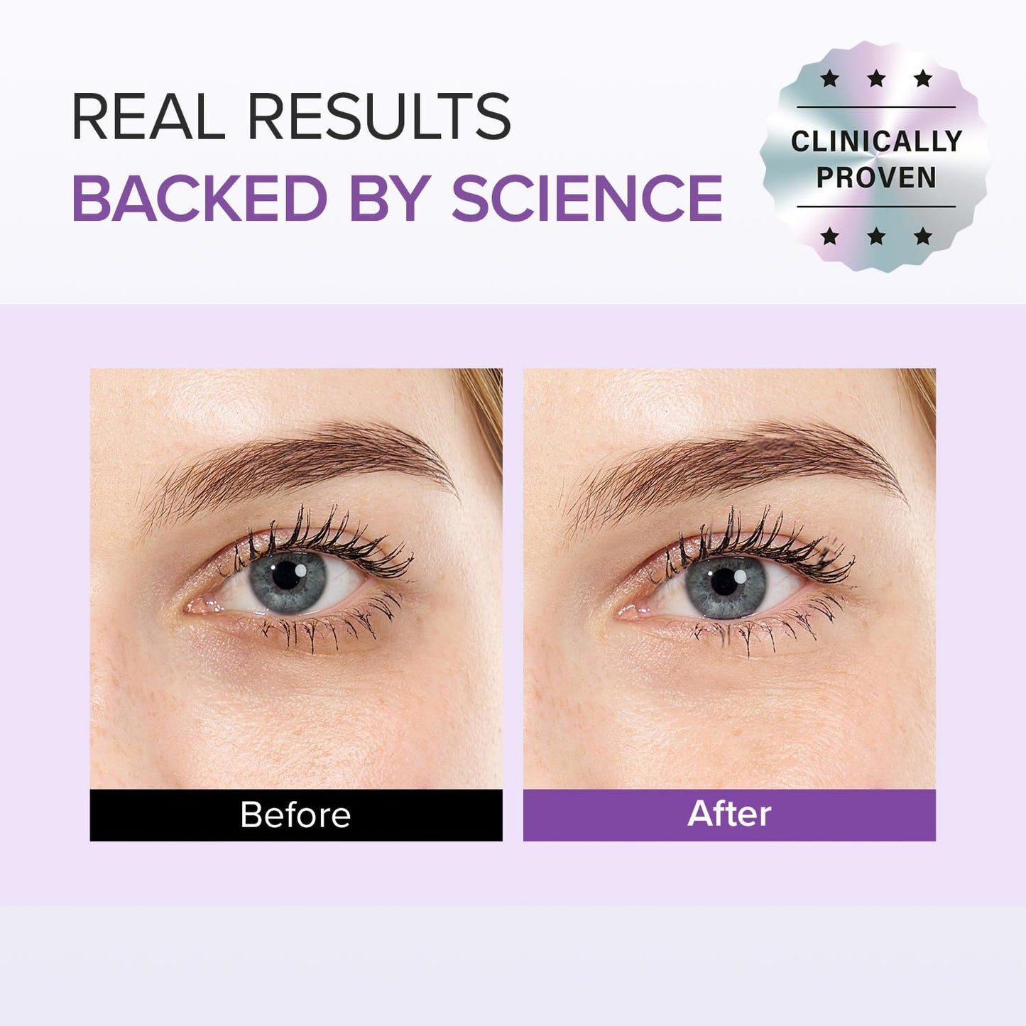 Mary and May under eye treatment for hyperpigmentation and dark spots