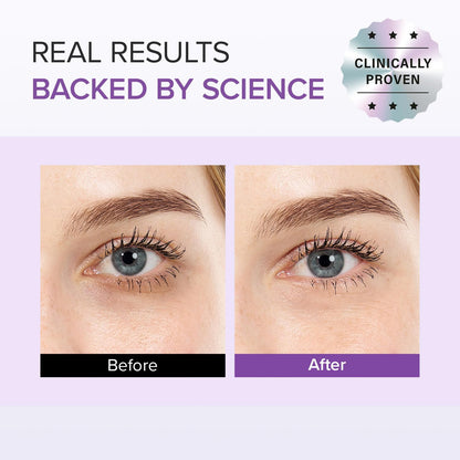 Mary and May under eye treatment for hyperpigmentation and dark spots