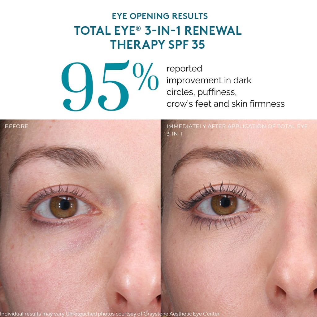 Colorescience Total Eye 3-In-1 Anti-Aging Renewal Therapy ingredient details
