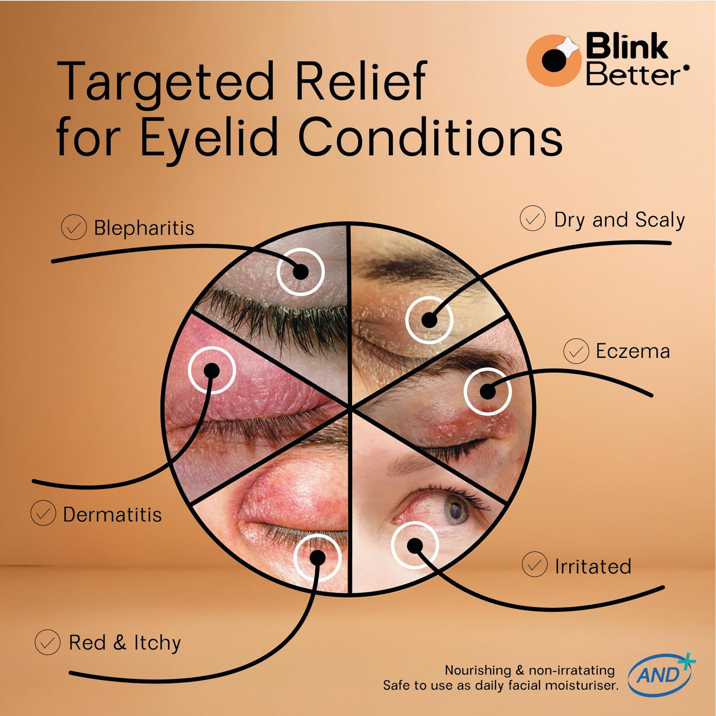 Optometrist developed BlinkBetter eyelid relief moisturizer being applied for barrier support