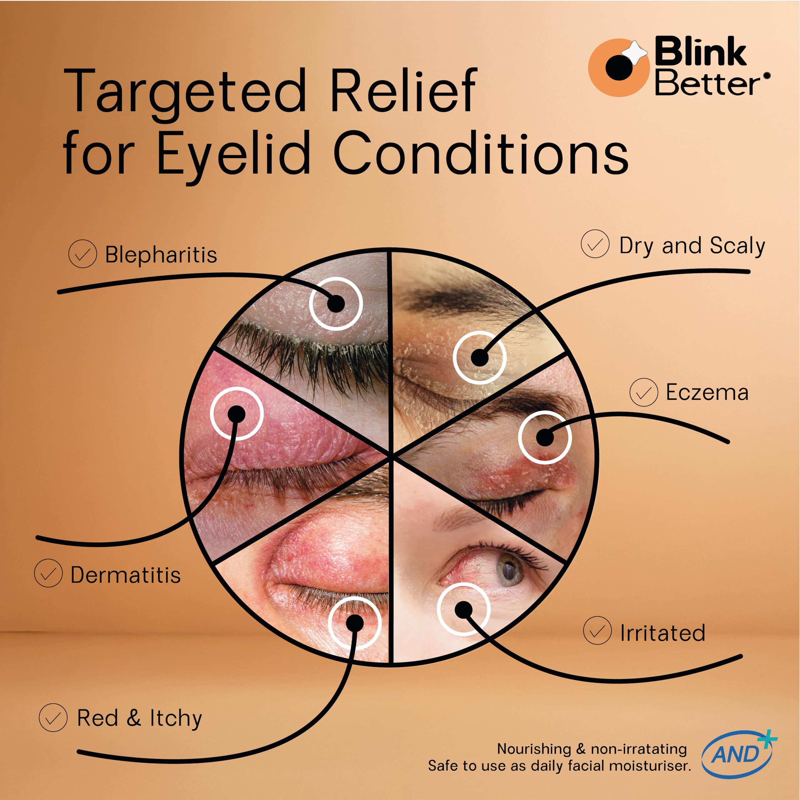 Optometrist developed BlinkBetter eyelid relief moisturizer being applied for barrier support