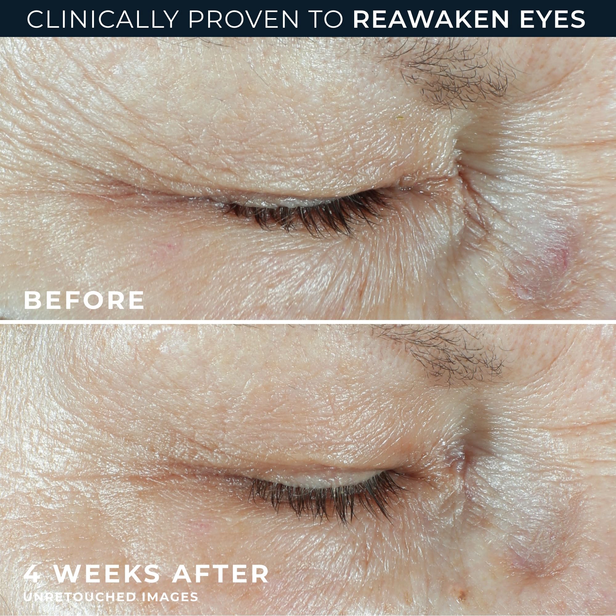 Close up of the lightweight hyaluronic acid eye treatment tube texture and design
