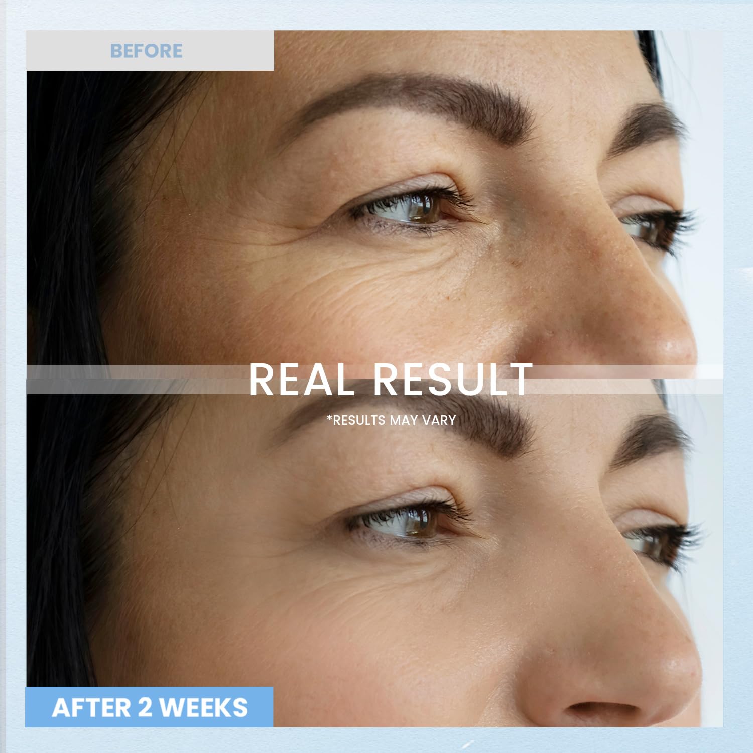 Applying Ronkie retinol eye cream to the under eye area