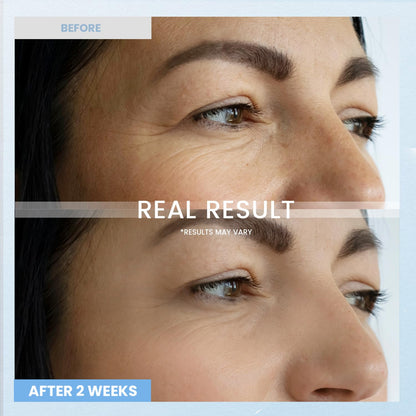 Applying Ronkie retinol eye cream to the under eye area