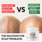 The Bald Brothers Bald Boss Scalp Moisturizer showing side packaging details and volume information