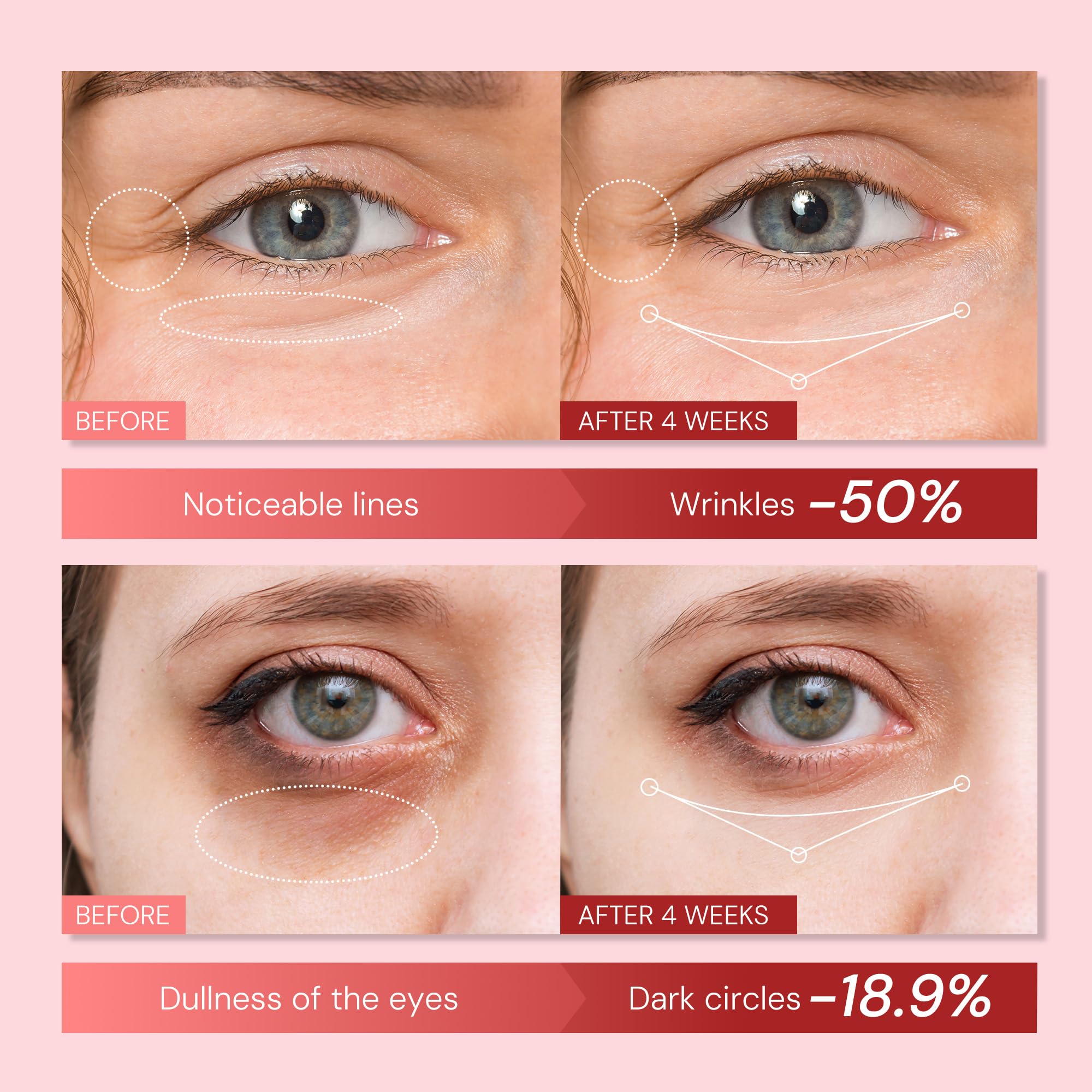 Enaskin Naturals Retinol Eye Cream red packaging box close up