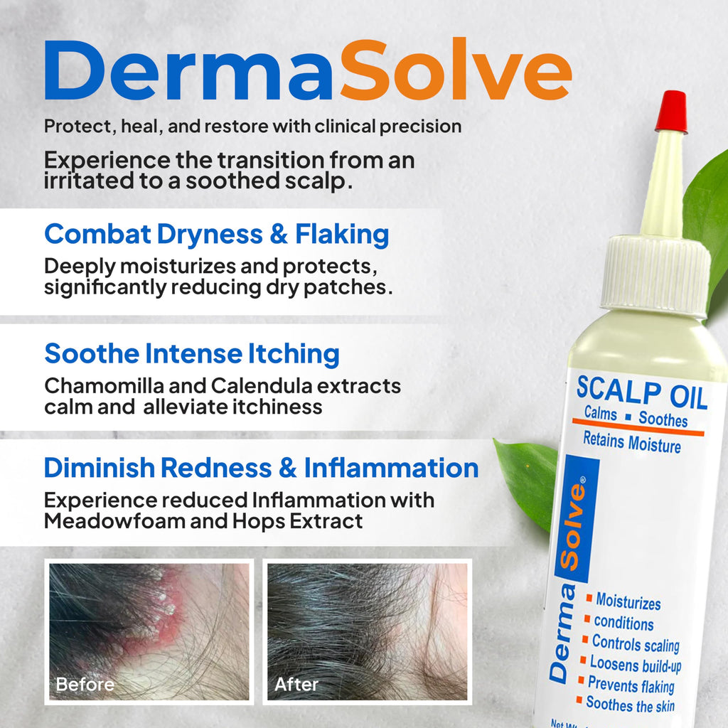 Dermasolve psoriasis scalp oil packaging showing size and brand