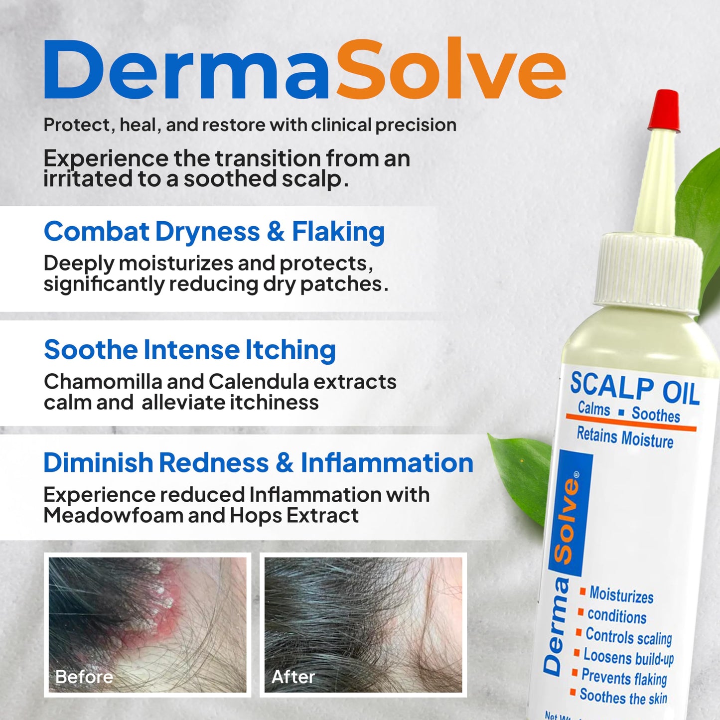 Dermasolve scalp oil 4 fluid ounce bottle packaging