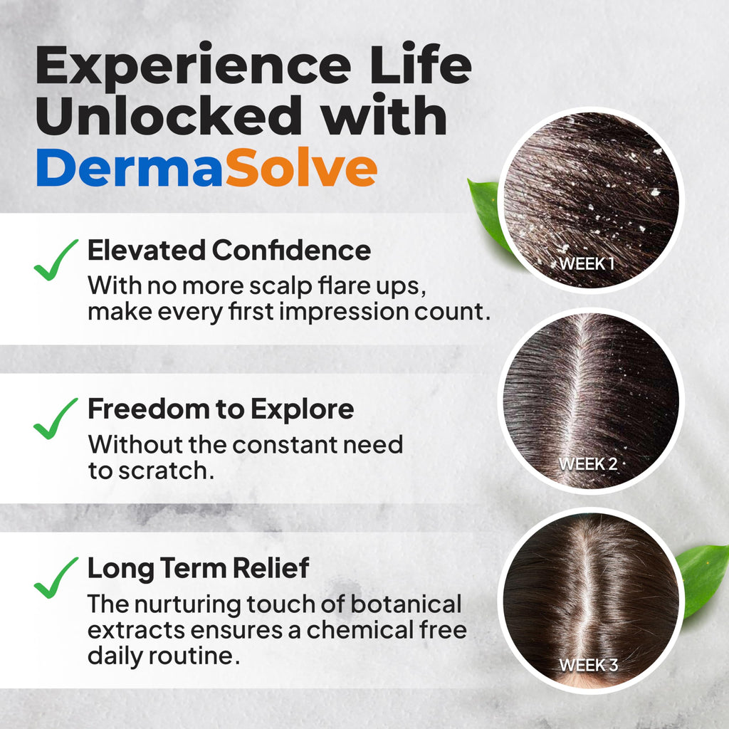 Close up of Dermasolve seborrheic dermatitis scalp treatment label