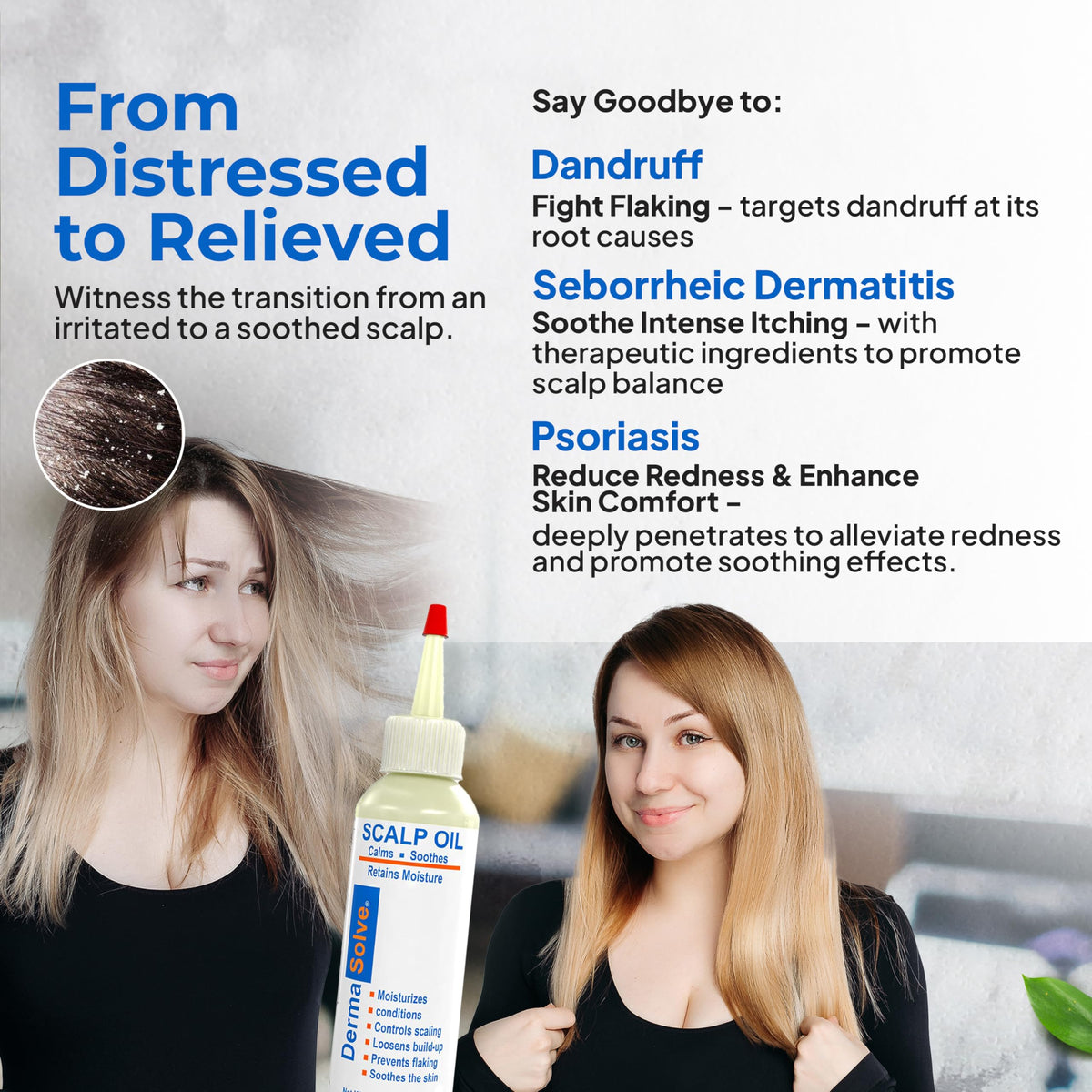 Dermasolve dermatologist approved scalp relief formula bottle