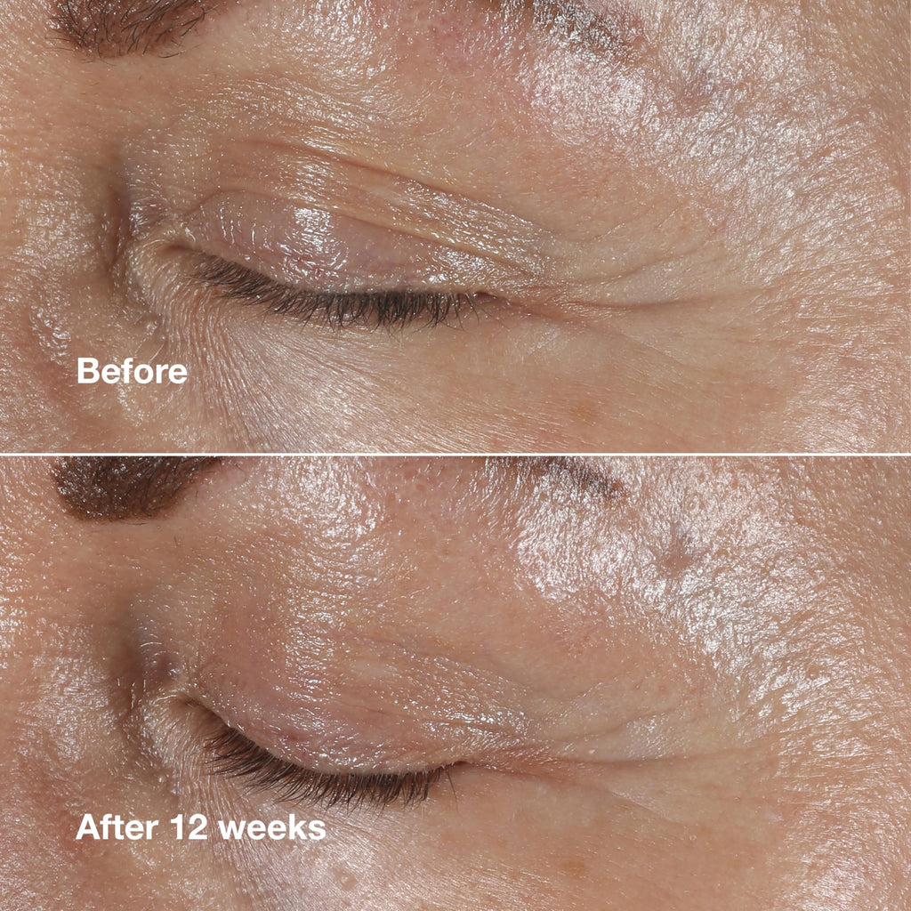 Clinique Smart Clinical Repair Wrinkle Correcting Eye Cream texture showcase