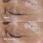 Clinique Smart Clinical Repair Wrinkle Correcting Eye Cream texture showcase