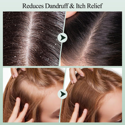 Voeruy hair care kit with applicator and scrub