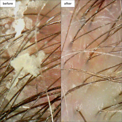 Briogeo Charcoal and Coconut Oil scalp treatment ingredients label