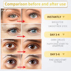 Model applying gold hydrogel eye patch for under eye dark circles and puffiness