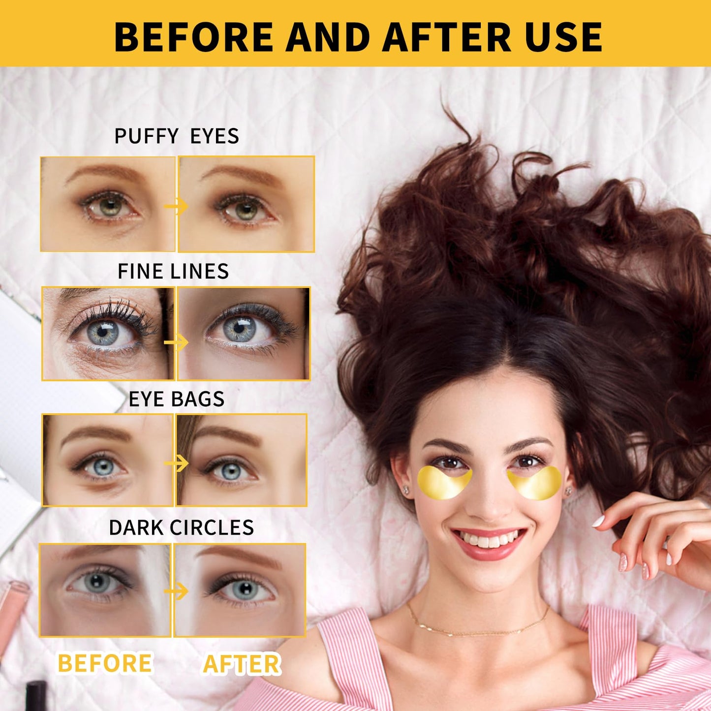 Authentic Treondexir eye patches for puffy eyes treatment