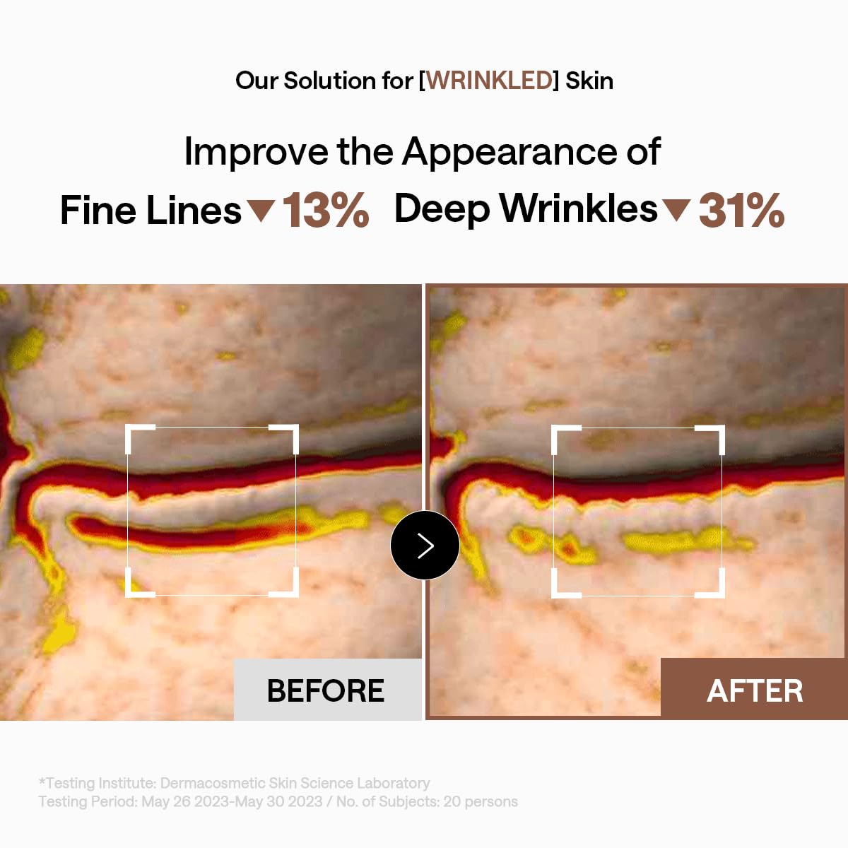 Mediheal cooling hydrogel patches applied to the under eye area