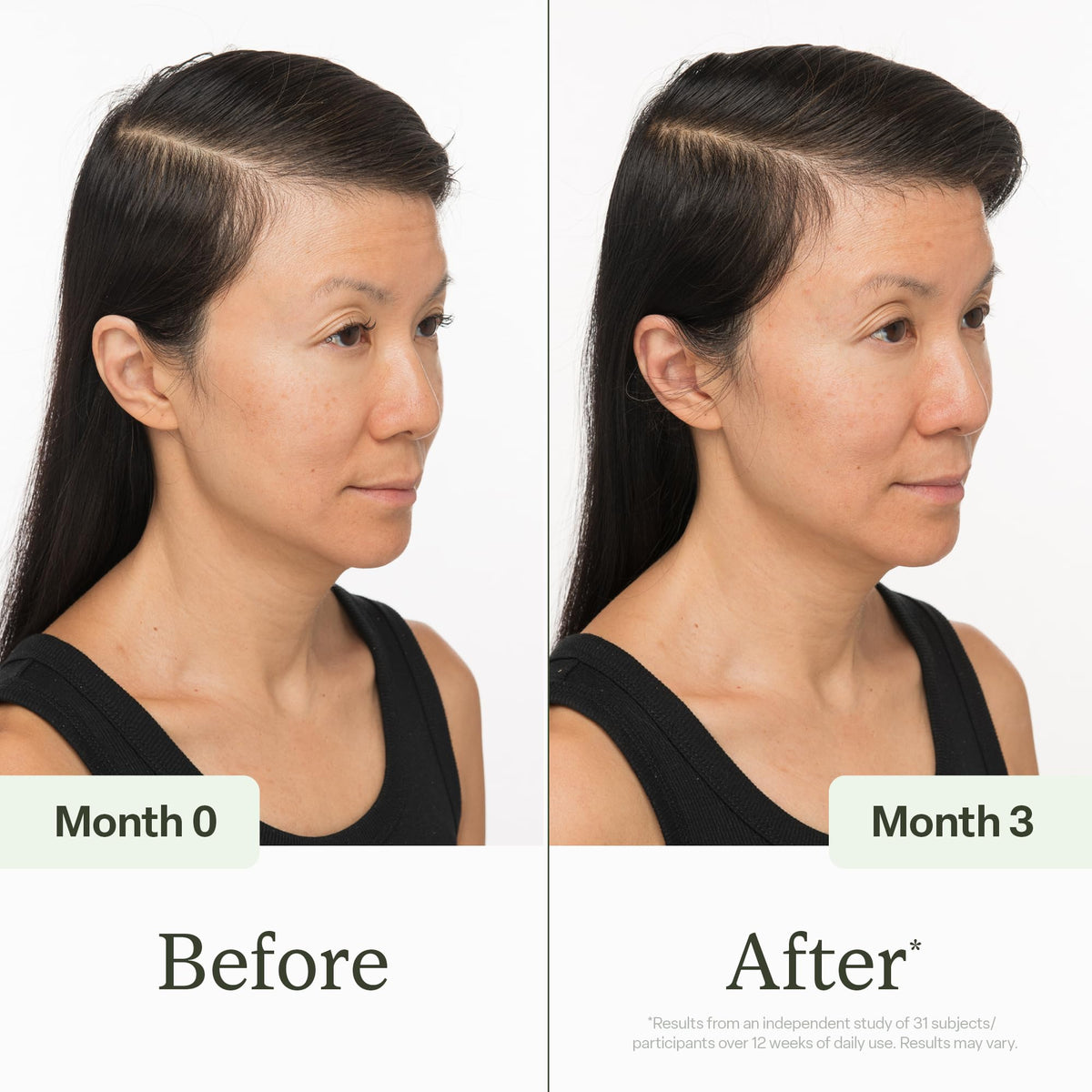 Divi thinning hair serum bottle angled display