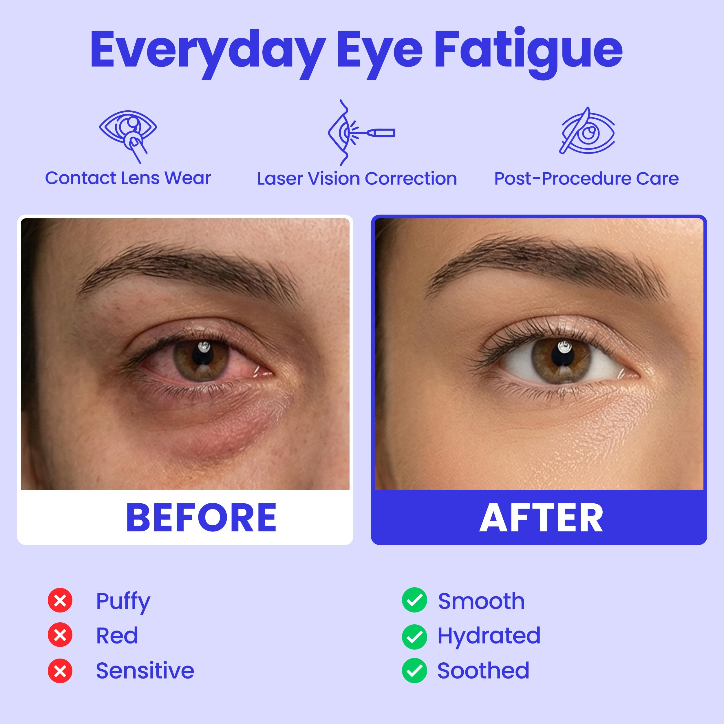 Air activated steam eye mask being opened for instant screen fatigue and stye relief