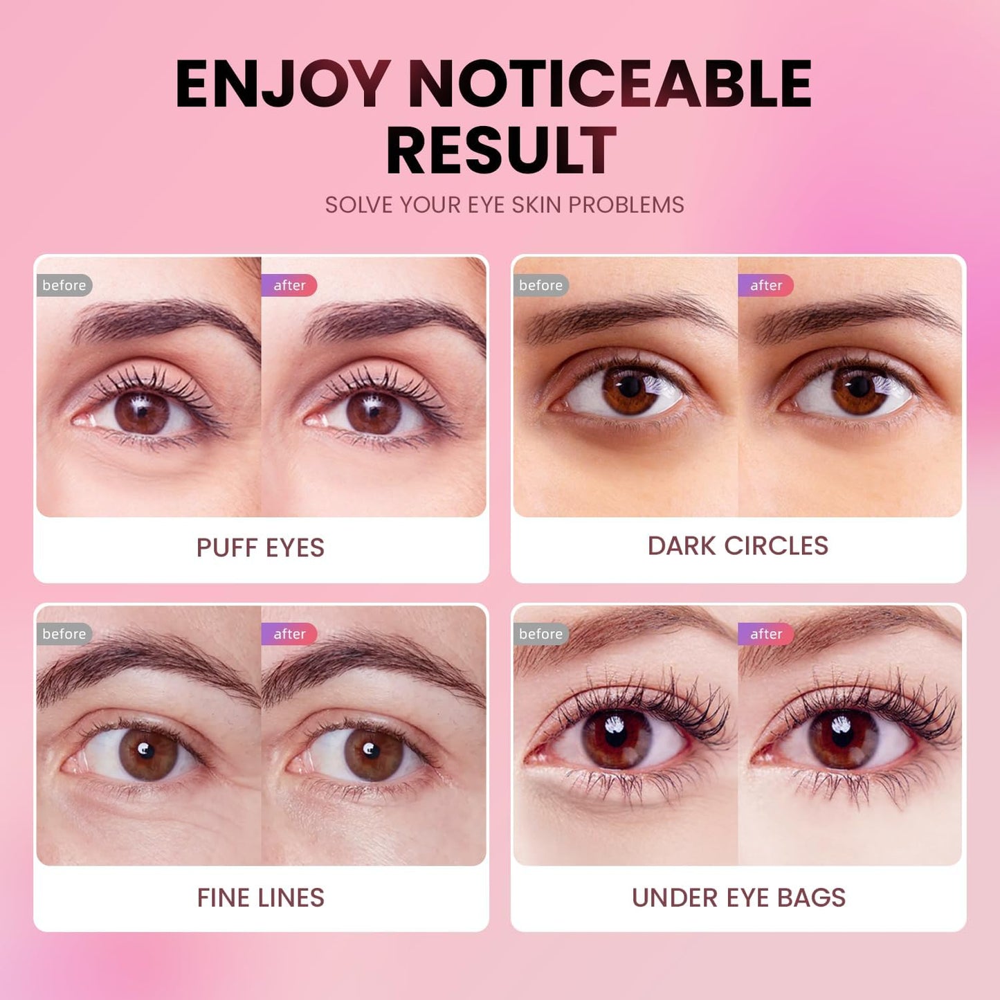 Premium USA imported AILEORY hydrogel eye patches skincare routine demonstration