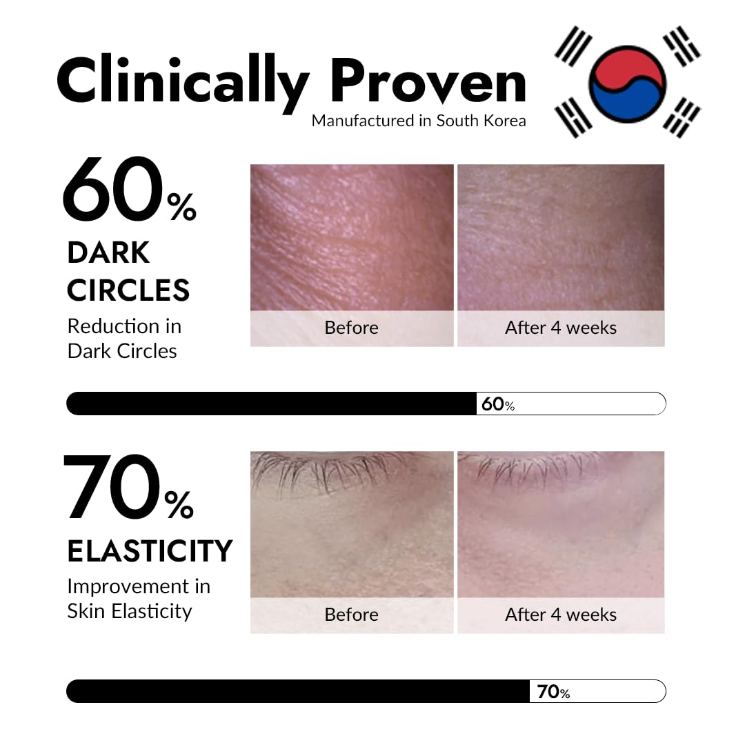 Korean skincare Mizon snail mucin eye mask application