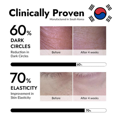 Korean skincare Mizon snail mucin eye mask application