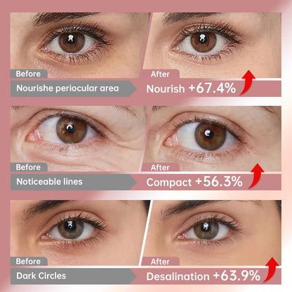 LLVYUO Novoy eye patches for wrinkles and puffiness showing 7 pairs packaging contents