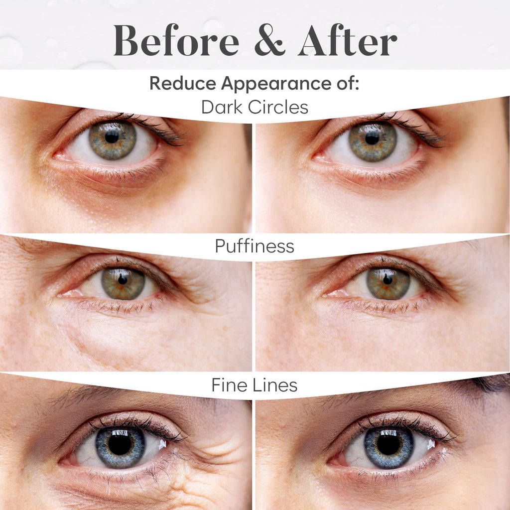 Model wearing Bloomora under eye patches for dark circles