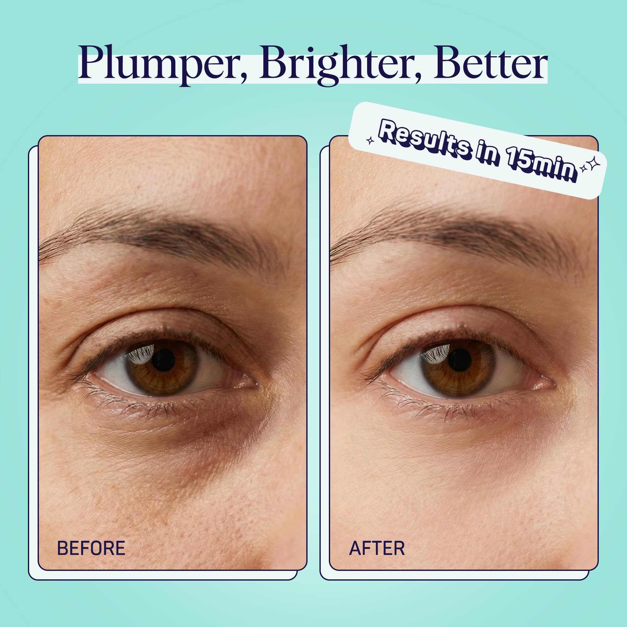 SpaLife cucumber eye patches Korean formula benefits