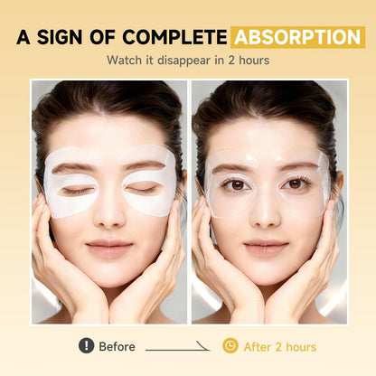 Authentic Natener 8 pairs box containing 5 percent PDRN brightening eye masks