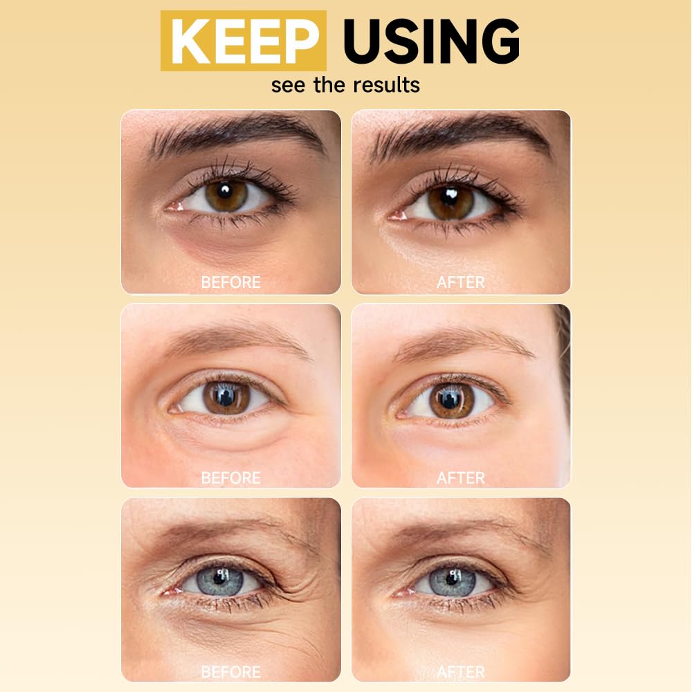 Lifestyle application of Natener eye masks for dark circles