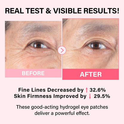 IMethod under eye mask white-to-transparent hydrogel patches displaying texture and shape details